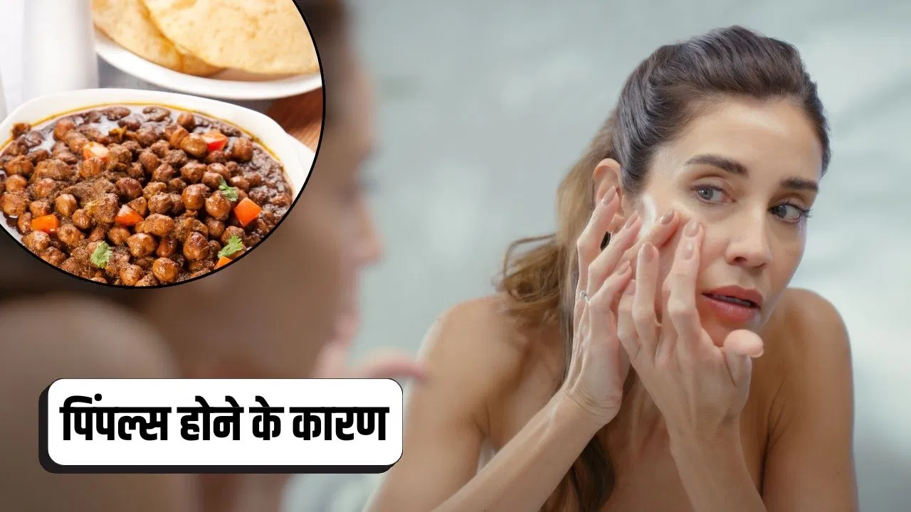 क्या ऑयली खाना भी पिंपल निकलने की वजह होता है? एक्सपर्ट से जानें क्या ऑयली खाना भी पिंपल निकलने की वजह होता है? एक्सपर्ट से जानें