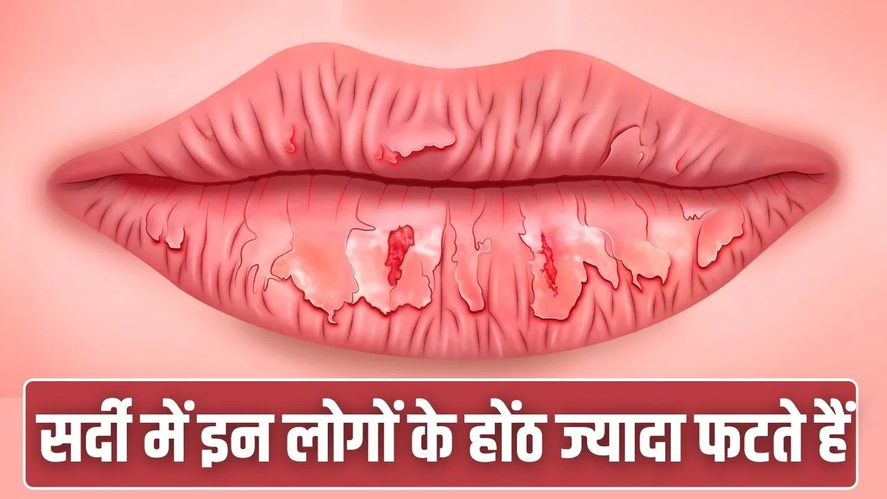 सर्दियों में इन लोगों के होंठ ज्यादा फटते हैं, रोज की ये आदत भी है वजह सर्दियों में इन लोगों के होंठ ज्यादा फटते हैं, रोज की ये आदत भी है वजह