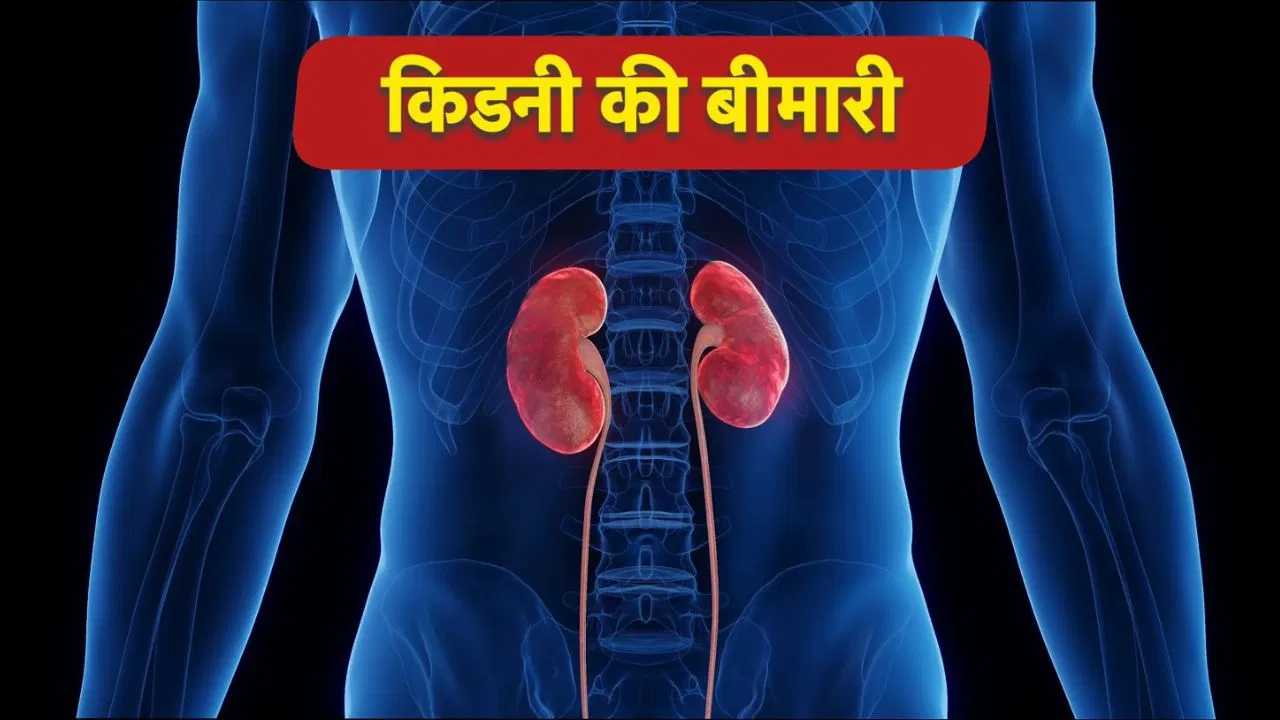 हर 10 में से 1 व्यक्ति को है क्रॉनिक किडनी डिजीज, ज्यादातर को नहीं होता पता हर 10 में से 1 व्यक्ति को है क्रॉनिक किडनी डिजीज, ज्यादातर को नहीं होता पता