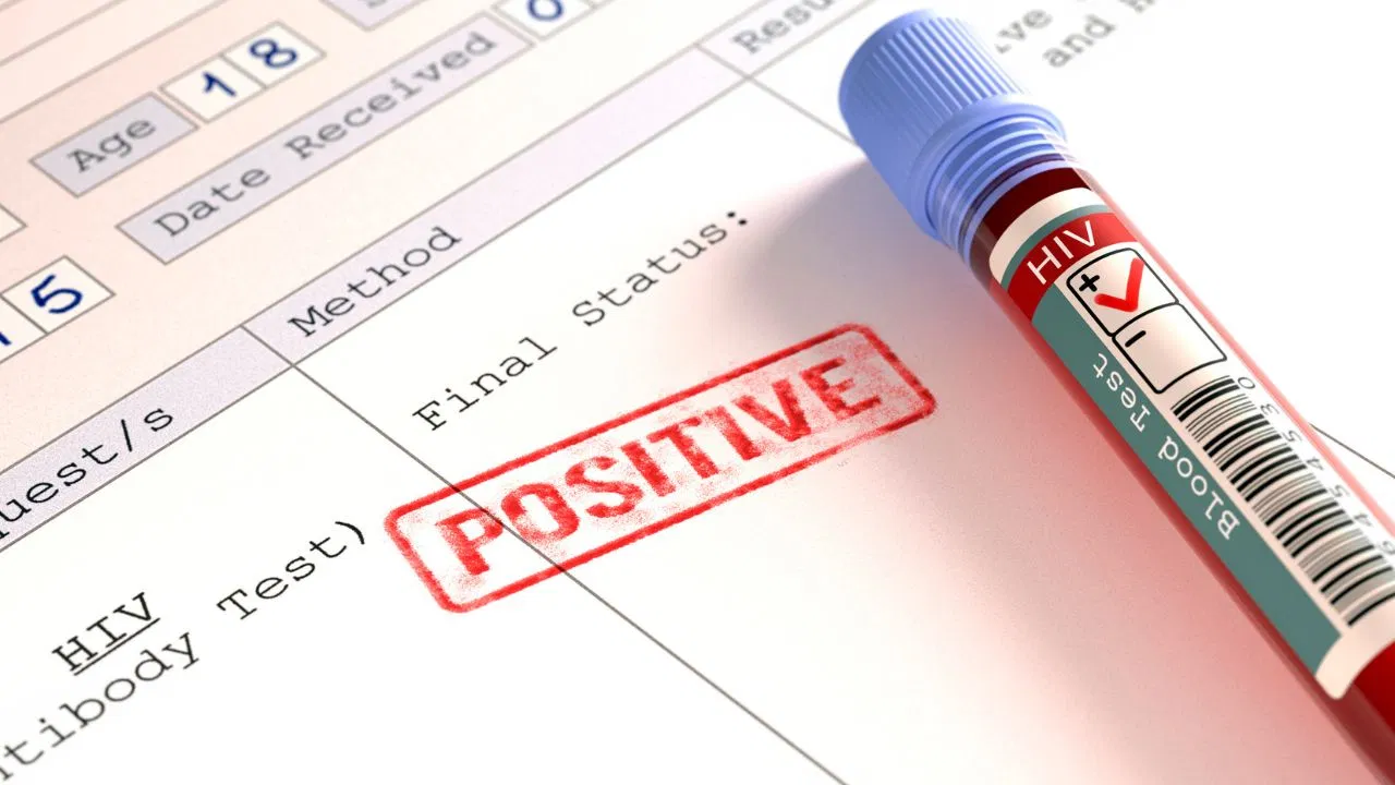 World AIDS Day: HIV का वायरस कितने सालों में एड्स बनता है, क्यों शुरुआत में लक्षणों का पता नहीं चलता World AIDS Day: HIV का वायरस कितने सालों में एड्स बनता है, क्यों शुरुआत में लक्षणों का पता नहीं चलता