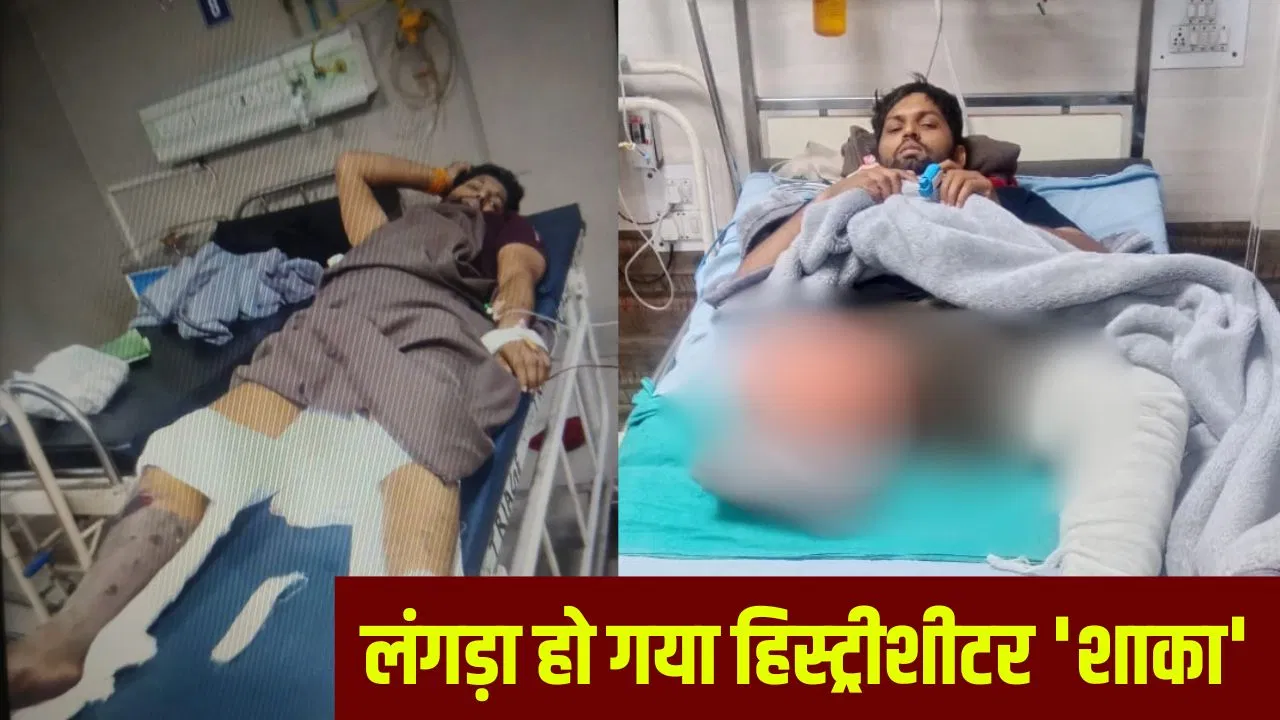 अलीगढ़ में हिस्ट्रीशीटर ‘शाका’ की काटी गई टांग, सिपाही को मारी थी गोली; खुद एनकाउंटर में गंवा बैठा पैर अलीगढ़ में हिस्ट्रीशीटर 'शाका' की काटी गई टांग, सिपाही को मारी थी गोली; खुद एनकाउंटर में गंवा बैठा पैर