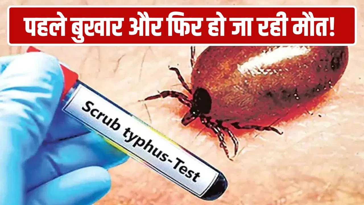 आंध्र प्रदेश: तेज बुखार, बदन दर्द और… मौतें; जंगल में रहने वाला ये कीड़ा ले रहा लोगों की जान आंध्र प्रदेश: तेज बुखार, बदन दर्द और... मौतें; जंगल में रहने वाला ये कीड़ा ले रहा लोगों की जान