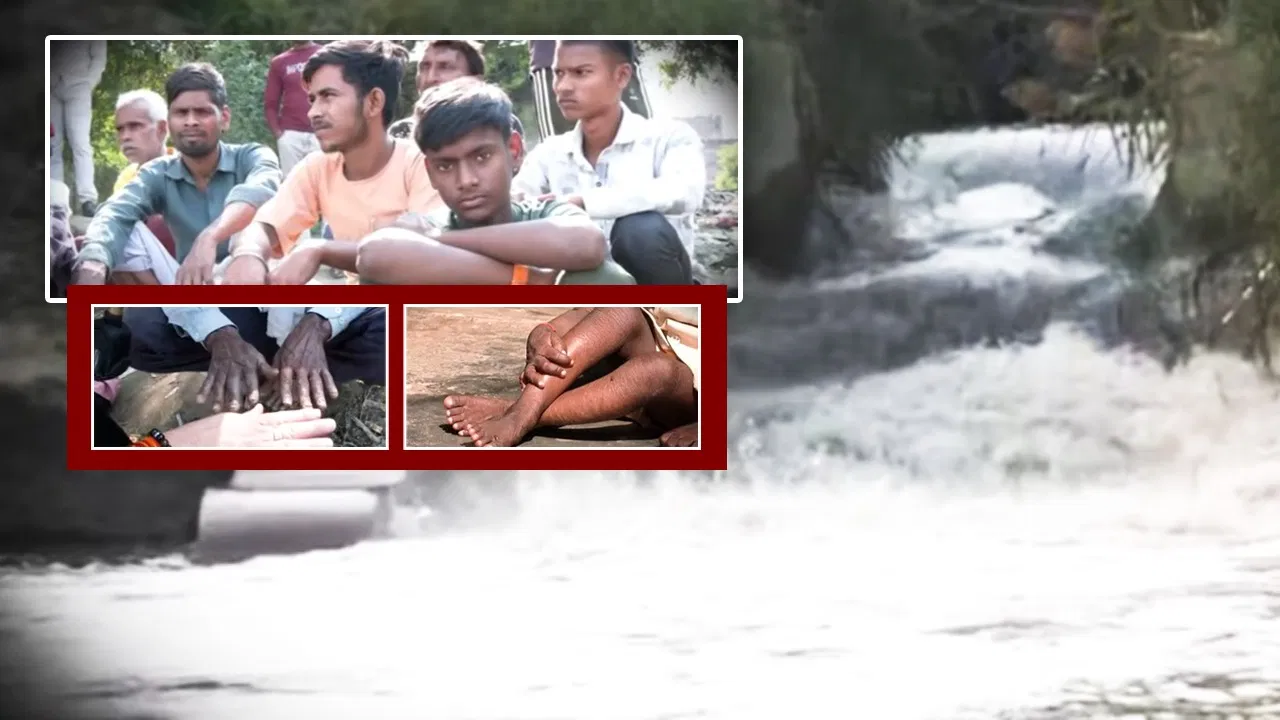 कैसे पानी बन गया ‘जहर’? किसी को ब्रेन ट्यूमर तो कोई जन्म से दिव्यांग, कहानी कानपुर के जाना गांव की कैसे पानी बन गया 'जहर'? किसी को ब्रेन ट्यूमर तो कोई जन्म से दिव्यांग, कहानी कानपुर के जाना गांव की