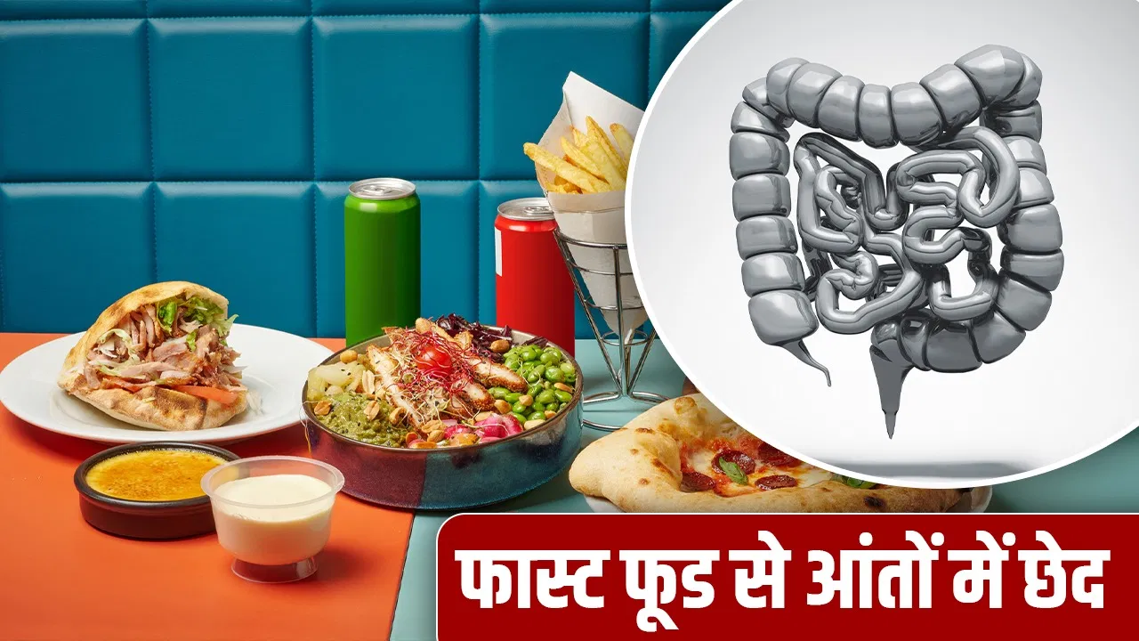 चाउमीन-पिज्जा ज्यादा न खाएं, आंतों में हो सकता है छेद? अमरोहा की घटना से समझें इसके खतरे चाउमीन-पिज्जा ज्यादा न खाएं, आंतों में हो सकता है छेद? अमरोहा की घटना से समझें इसके खतरे