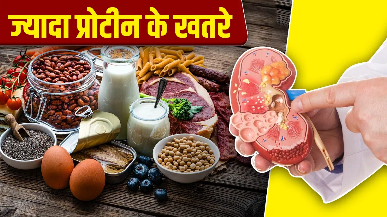 ज्यादा प्रोटीन डाइट कहीं किडनी को तो नहीं कर रही नुकसान? एक्सपर्ट की चेतावनी ज्यादा प्रोटीन डाइट कहीं किडनी को तो नहीं कर रही नुकसान? एक्सपर्ट की चेतावनी