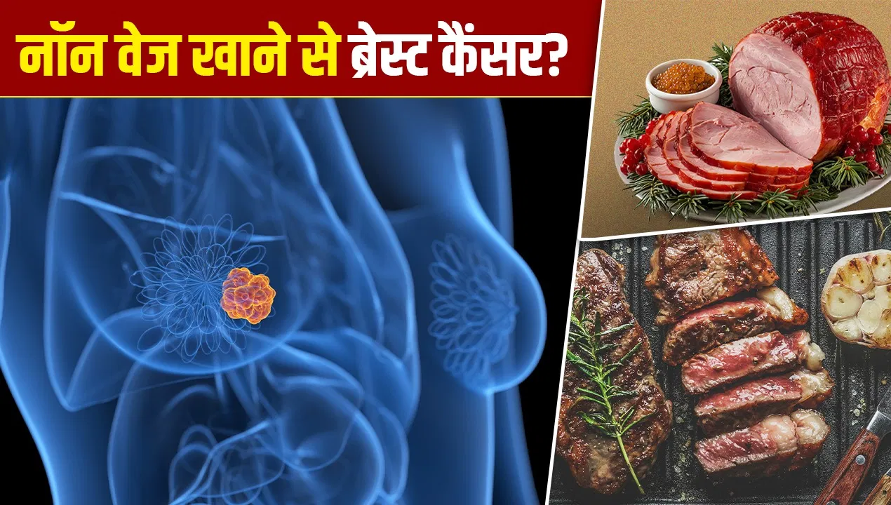 बेकन, सलामी और प्रोसेस्ड मीट बढ़ा देते हैं कैंसर का रिस्क… ICMR की रिसर्च पर डॉक्टर का दावा बेकन, सलामी और प्रोसेस्ड मीट बढ़ा देते हैं कैंसर का रिस्क... ICMR की रिसर्च पर डॉक्टर का दावा