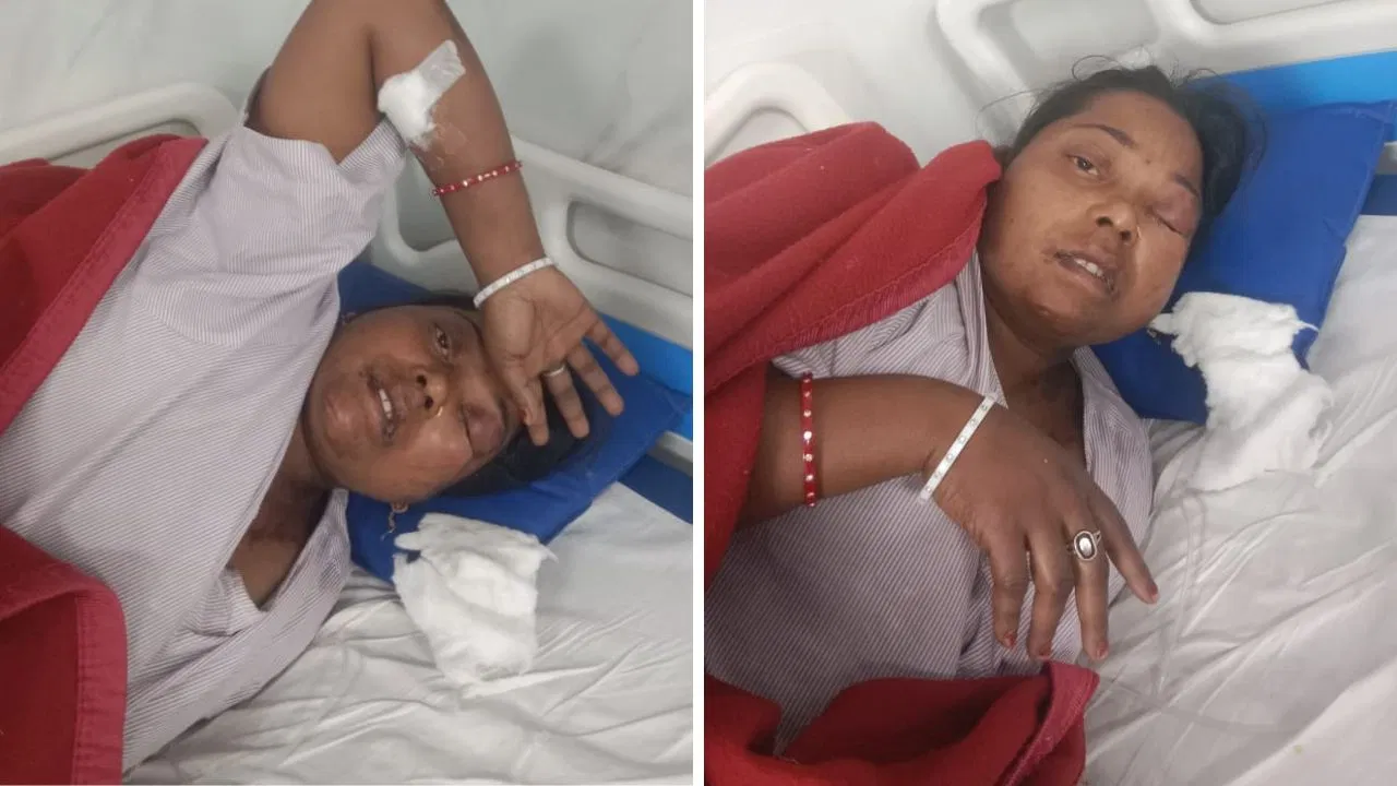 5 साल बाद दिल्ली से भागलपुर लौटा पति… बीवी पर फेंका तेजाब, फिर खुद कर लिया सुसाइड 5 साल बाद दिल्ली से भागलपुर लौटा पति... बीवी पर फेंका तेजाब, फिर खुद कर लिया सुसाइड