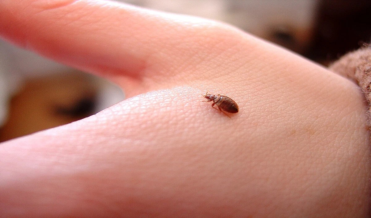 Bed Bugs Home Remedies: Bed Bugs का आतंक होगा खत्म, किचन की ये चीजें हैं रामबाण, जानें Best Home Remedies Bed Bugs Home Remedies: Bed Bugs का आतंक होगा खत्म, किचन की ये चीजें हैं रामबाण, जानें Best Home Remedies
