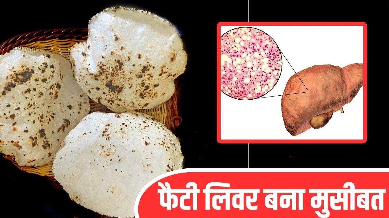 Fatty Liver reduce Diet: फैटी लिवर है तो गेहूं की रोटी खानी चाहिए या नहीं? एक्सपर्ट से जानें Fatty Liver reduce Diet: फैटी लिवर है तो गेहूं की रोटी खानी चाहिए या नहीं? एक्सपर्ट से जानें