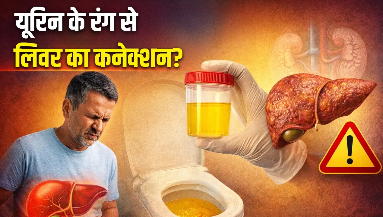 क्या पीले पेशाब का मतलब लिवर खराब होना है? AIIMS के डॉक्टर से जानें क्या पीले पेशाब का मतलब लिवर खराब होना है? AIIMS के डॉक्टर से जानें