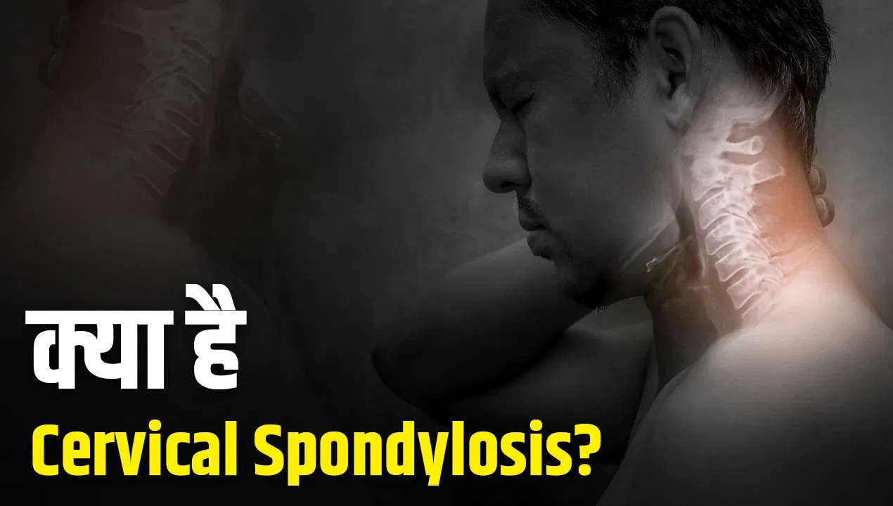 गर्दन में दर्द और सिर रहता है भारी… ये Cervical Spondylosis की शुरुआत तो नहीं? गर्दन में दर्द और सिर रहता है भारी... ये Cervical Spondylosis की शुरुआत तो नहीं?