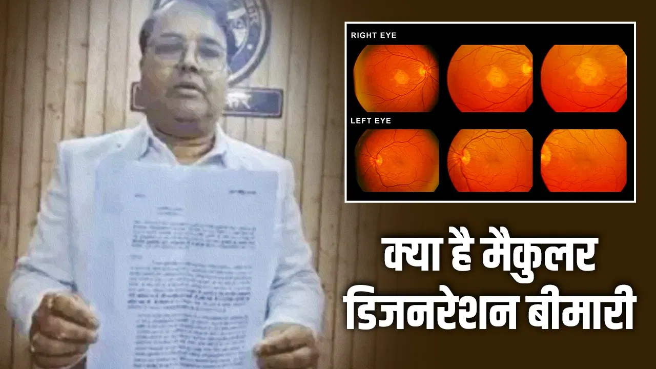 जिस बीमारी के आधार पर PCS बने प्रशांत सिंह वह किस उम्र में होती है? सगे भाई के आरोप पर क्या बोले डॉक्टर जिस बीमारी के आधार पर PCS बने प्रशांत सिंह वह किस उम्र में होती है? सगे भाई के आरोप पर क्या बोले डॉक्टर