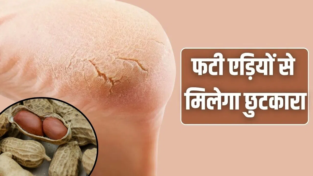 दरारे भरेंगी, एड़ियां बनेगी सॉफ्ट, सर्दियों के स्नैक मूंगफली के छिलके से ऐसे बनाएं फुट मास्क दरारे भरेंगी, एड़ियां बनेगी सॉफ्ट, सर्दियों के स्नैक मूंगफली के छिलके से ऐसे बनाएं फुट मास्क