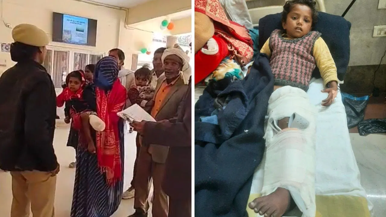 फ्रैक्चर हुआ तो बांध दी टाइट पट्टी, जमा खून और काटना पड़ा पैर… बांदा में डॉक्टर की लापरवाही, अब कभी नहीं चल पाएगी 5 साल की मासूम फ्रैक्चर हुआ तो बांध दी टाइट पट्टी, जमा खून और काटना पड़ा पैर... बांदा में डॉक्टर की लापरवाही, अब कभी नहीं चल पाएगी 5 साल की मासूम