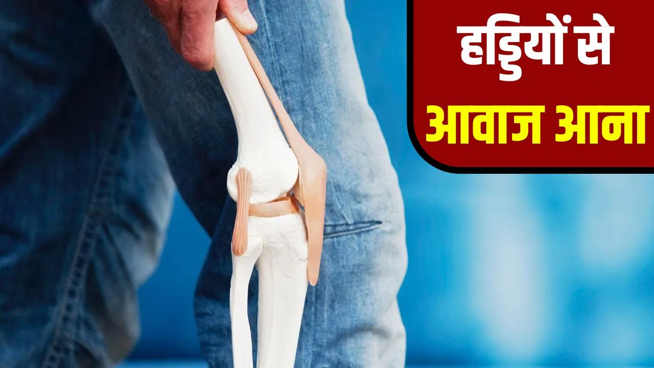 किस बीमारी के कारण हड्डियों से कट-कट की आवाज आती है? किस बीमारी के कारण हड्डियों से कट-कट की आवाज आती है?