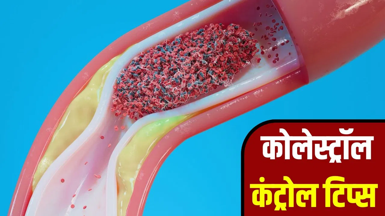 कोलेस्ट्रॉल को करना है कंट्रोल तो रोज करें ये काम, डॉक्टर ने बताया कोलेस्ट्रॉल को करना है कंट्रोल तो रोज करें ये काम, डॉक्टर ने बताया