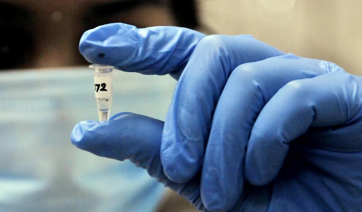 Russia Mysterious Virus | हाथ से छूटी ‘बायोलॉजिकल’ टेस्ट ट्यूब और तड़प-तड़प कर हुई मौत! रूस से आई वायरस लीक होने की खबर से पूरी दुनिया में दहशत Russia Mysterious Virus | हाथ से छूटी 'बायोलॉजिकल' टेस्ट ट्यूब और तड़प-तड़प कर हुई मौत! रूस से आई वायरस लीक होने की खबर से पूरी दुनिया में दहशत